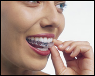 <em>Invisalign</em> Step 2